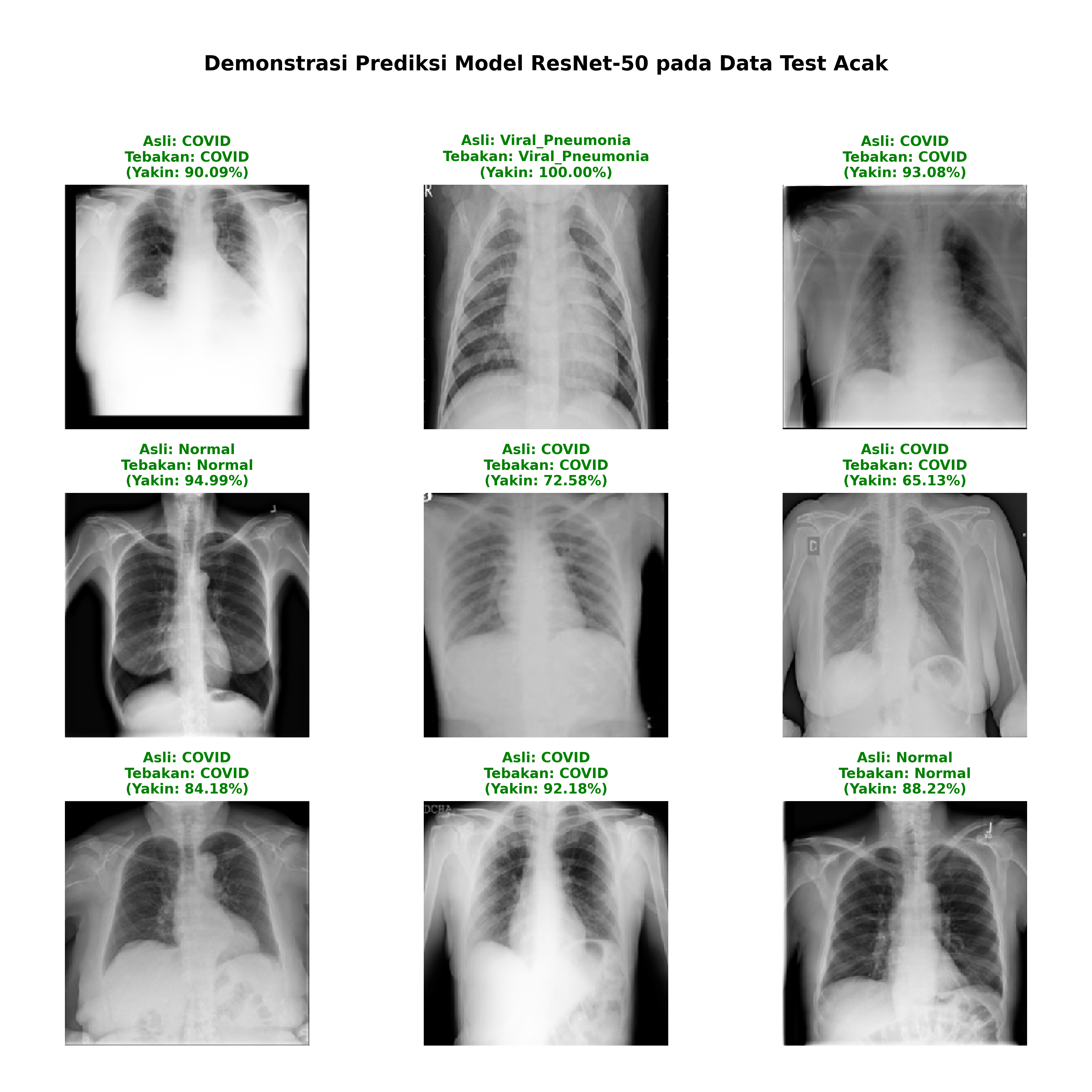 Grad CAM Predictions